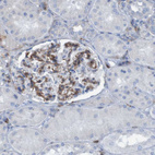 Immunohistochemical staining of human kidney shows moderate membranous positivity in cells in glomeruli.