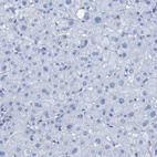 Anti-RNF182 Antibody