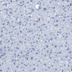 Immunohistochemical staining of human liver shows no positivity in hepatocytes as expected.