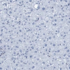 Immunohistochemical staining of human liver shows no positivity in hepatocytes as expected.