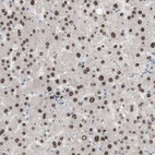 Anti-PHTF2 Antibody