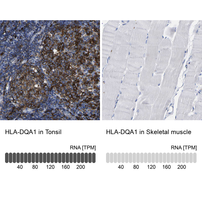 Anti-HLA-DQA1 Antibody