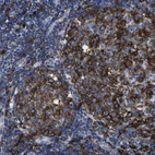 Immunohistochemical staining of human tonsil shows strong membranous positivity in germinal center cells.