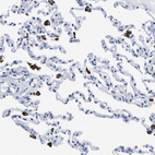 Anti-HLA-DQA1 Antibody