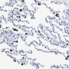 Immunohistochemical staining of human lung shows strong cytoplasmic positivity in macrophages.
