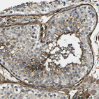 Immunohistochemical staining of human testis shows moderate to strong membranous positivity in cells in seminiferous ducts.