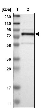 Lane 1: Marker [kDa] 230, 130, 95, 72, 56, 36, 28, 17, 11_br/_Lane 2: Human cell line RT-4