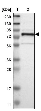 Lane 1: Marker [kDa] 230, 130, 95, 72, 56, 36, 28, 17, 11_br/_Lane 2: Human cell line RT-4