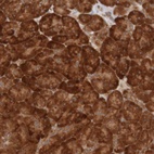 Anti-MRPL52 Antibody