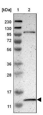 Lane 1: Marker [kDa] 230, 130, 95, 72, 56, 36, 28, 17, 11_br/_Lane 2: Human cell line RT-4