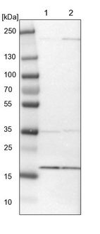 Lane 1: NIH-3T3 cell lysate (Mouse embryonic fibroblast cells)_br/_Lane 2: NBT-II cell lysate (Rat Wistar bladder tumour cells)