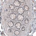 Immunohistochemical staining of human rectum shows weak to moderate cytoplasmic positivity in lymphoid cells.