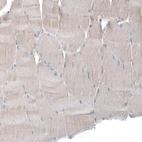 Immunohistochemical staining of human skeletal muscle shows low positivity in myocytes as expected.