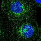 Immunofluorescent staining of human cell line A-431 shows localization to plasma membrane & vesicles.