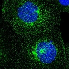 Immunofluorescent staining of human cell line A-431 shows localization to plasma membrane & vesicles.