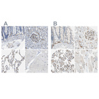 Immunohistochemical staining of human colon, kidney, lung and skeletal muscle using Anti-CD93 antibody HPA012368 (A) shows similar protein distribution across tissues to independent antibody HPA009300 (B).