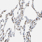 Immunohistochemical staining of human lung shows strong membranous positivity in endothelial cells.