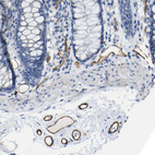 Immunohistochemical staining of human colon shows strong membranous positivity in endothelial cells.