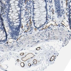 Immunohistochemical staining of human colon shows strong membranous positivity in endothelial cells.