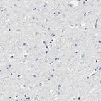 Immunohistochemical staining of human cerebral cortex shows low expression as expected.