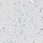 Immunohistochemical staining of human cerebral cortex shows low expression as expected.