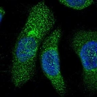 Immunofluorescent staining of human cell line A-431 shows localization to endoplasmic reticulum.