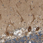 Anti-LRCH3 Antibody