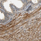 Immunohistochemical staining of human prostate shows moderate cytoplasmic positivity in smooth muscle cells.