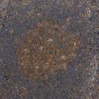 Immunohistochemical staining of human tonsil shows moderate cytoplasmic positivity in germinal center cells.