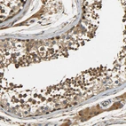 Immunohistochemical staining of human testis shows moderate cytoplasmic positivity in cells in seminiferous ducts and Leydig cells.