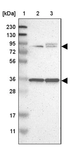 Lane 1: Marker [kDa] 230, 130, 95, 72, 56, 36, 28, 17, 11_br/_Lane 2: Human cell line RT-4_br/_Lane 3: Human cell line U-251MG sp