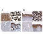 Immunohistochemical staining of human esophagus, placenta, skeletal muscle and skin using Anti-ENDOU antibody HPA012388 (A) shows similar protein distribution across tissues to independent antibody HPA067448 (B).