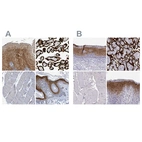 Immunohistochemical staining of human esophagus, placenta, skeletal muscle and skin using Anti-ENDOU antibody HPA012388 (A) shows similar protein distribution across tissues to independent antibody HPA067448 (B).