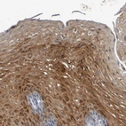 Immunohistochemical staining of human esophagus shows strong cytoplasmic positivity in squamous epithelial cells.
