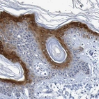 Immunohistochemical staining of human skin shows strong cytoplasmic positivity in squamous epithelial cells.
