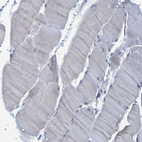 Immunohistochemical staining of human skeletal muscle shows no positivity in myocytes as expected.