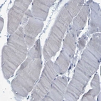 Immunohistochemical staining of human skeletal muscle shows no positivity in myocytes as expected.
