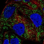 Immunofluorescent staining of human cell line EFO-21 shows localization to mitochondria.
