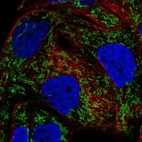 Immunofluorescent staining of human cell line EFO-21 shows localization to mitochondria.