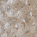 Immunohistochemical staining of human cerebral cortex shows moderate positivity in neuropil.