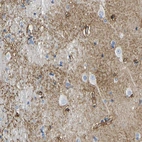 Immunohistochemical staining of human cerebral cortex shows moderate positivity in neuropil.