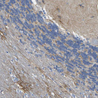 Immunohistochemical staining of human cerebellum shows weak positivity in neuropil.