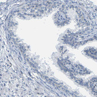 Immunohistochemical staining of human prostate shows no positivity in glandular cells as expected.