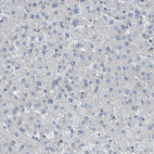 Immunohistochemical staining of human liver shows no positivity in hepatocytes as expected.