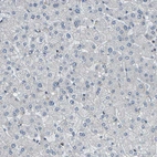 Immunohistochemical staining of human liver shows no positivity in hepatocytes as expected.