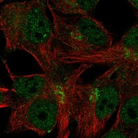 Anti-C11orf24 Antibody