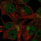 Anti-C11orf24 Antibody