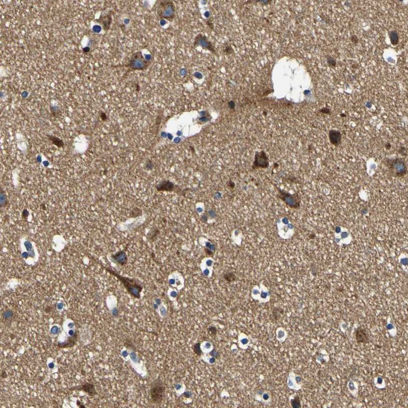 Anti-CLSTN1 Antibody