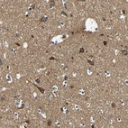 Anti-CLSTN1 Antibody