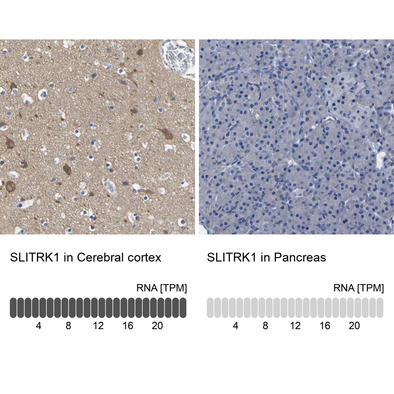Anti-SLITRK1 Antibody